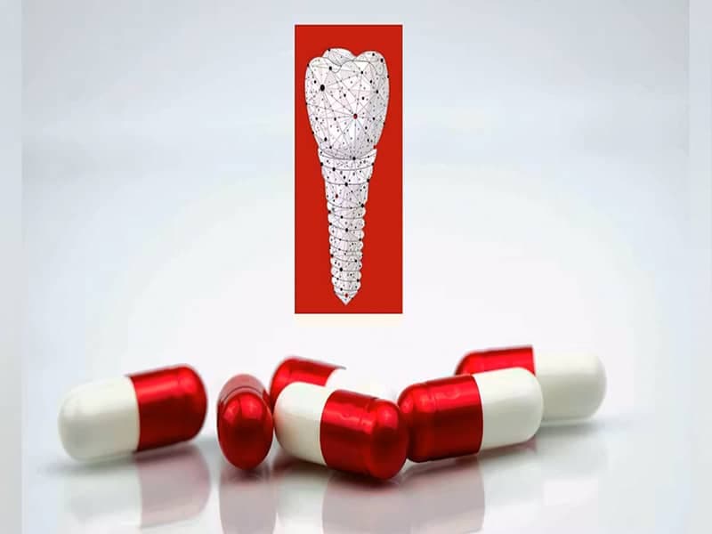 بعد از ایمپلنت چند روز آنتیبیوتیک بخوریم؟